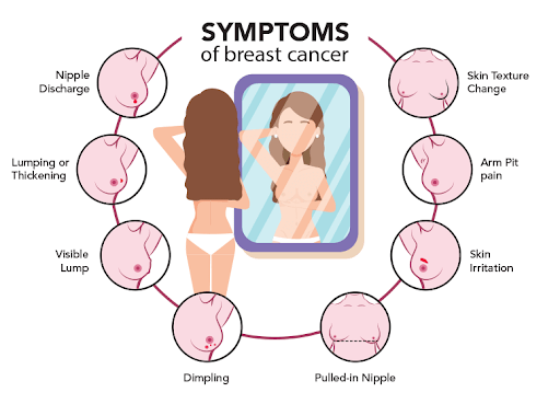 Καρκίνος του μαστού: Κλινικά σημεία
